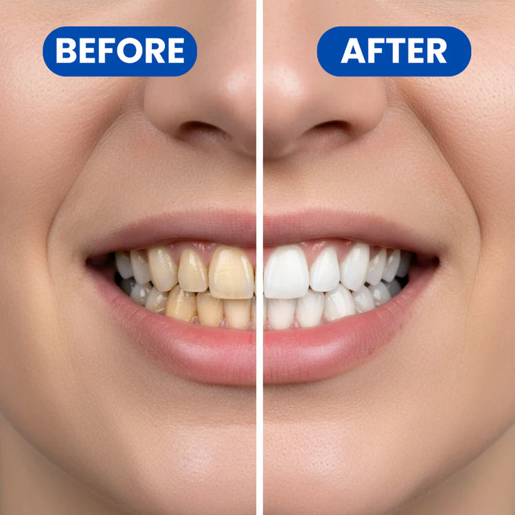Purple Teeth Whitening Strips (Pack of 7)